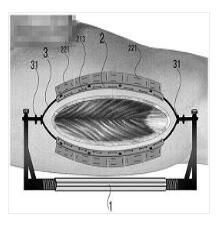 一種皮膚擴(kuò)張器及其使用方法
