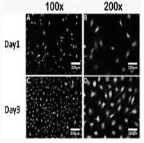 一種醫(yī)用金屬骨植入材料的制備方法