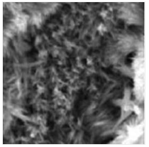 一種醫(yī)用金屬骨植入材料